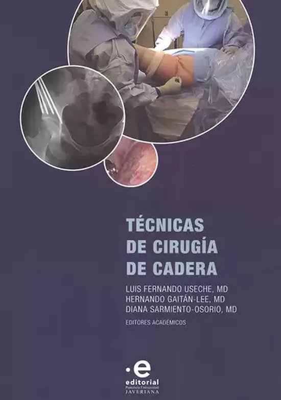 Medicina - Técnicas de cirugía de cadera - cover