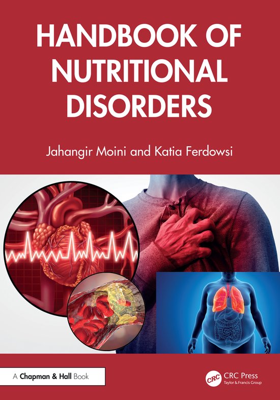 Handbook of Nutritional Disorders - cover