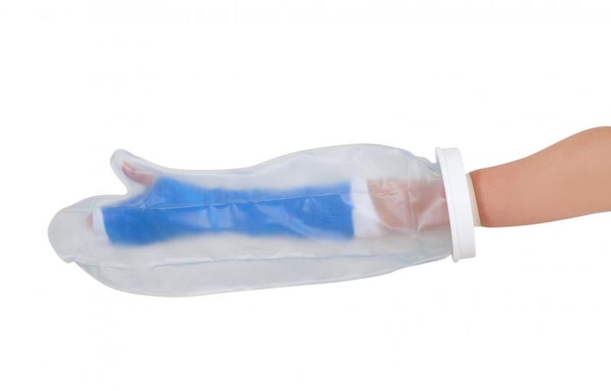 Goedkoopste Able 2 gipshoes halve arm - volwassenen