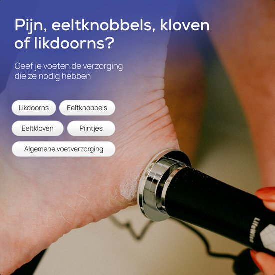 LifeWise Elektrische Eeltverwijderaar - 60 Vervangbare Schuurpads - Hygiënisch - Netstroom Adapter - Voetvijl - Zwart