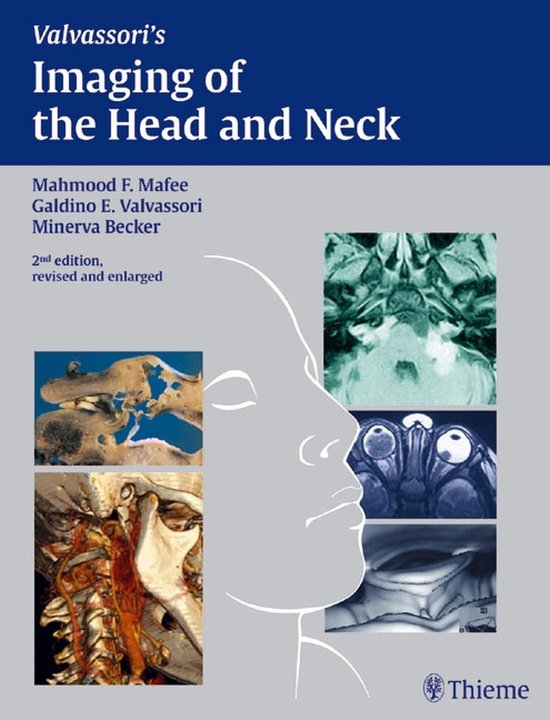 Imaging of the Head and Neck - cover