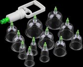 Professionele Cupping Set - Massage - Cup - Welness - Doorbloeding - Cuppen - Soepele Spieren
