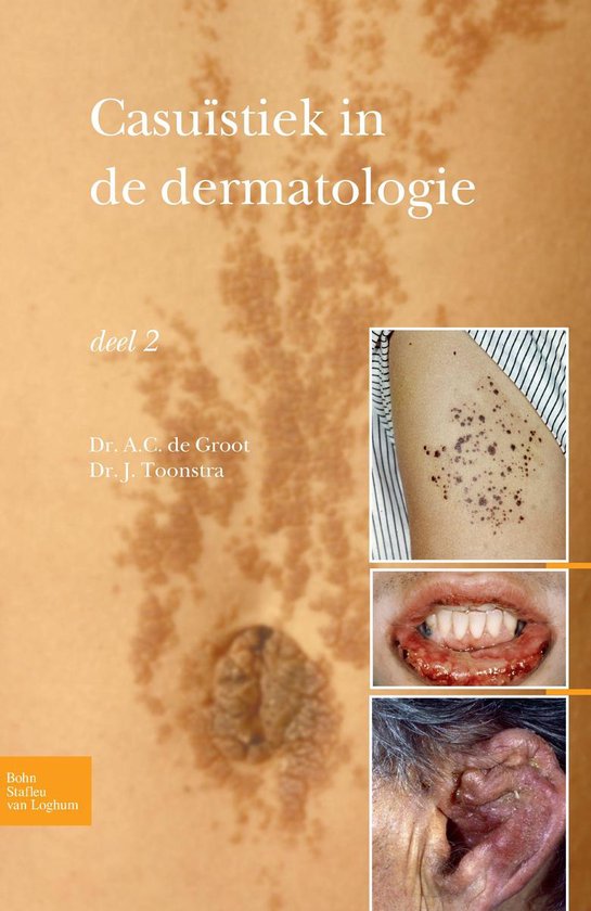 Casuïstiek in de dermatologie / deel 2 - Johan Toonstra | Tiliboo-afrobeat.com
