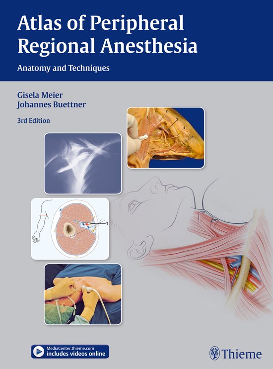 Atlas of Peripheral Regional Anesthesia - cover