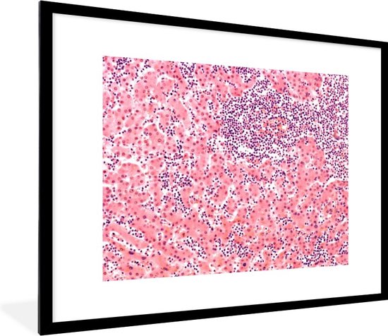 Photo encadrée - Cellules sanguines sous cadre photo microscope 80x60 cm - Affiche encadrée (Décoration murale salon / chambre)