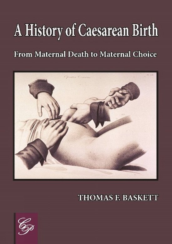 Omslag van History of Caesarean Birth door Thomas F Baskett