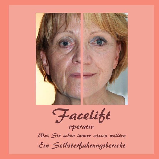 Facelift operativ - cover