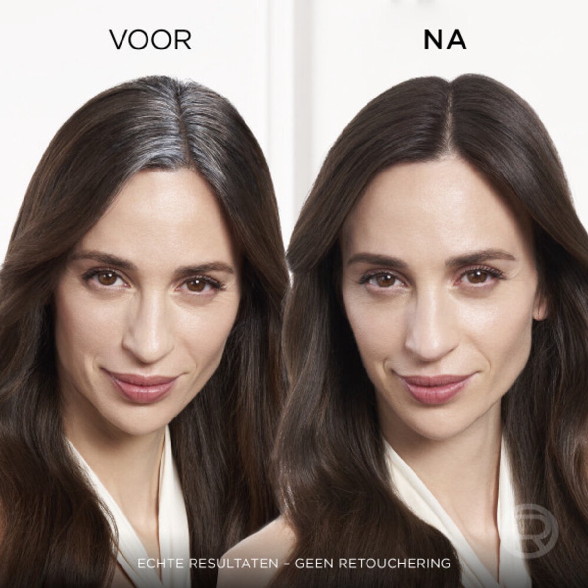 L'Oréal Paris Magic Retouch Donkerblond Camouflerende Uitgroeispray Voordeelverpakking - 6 x 75ml