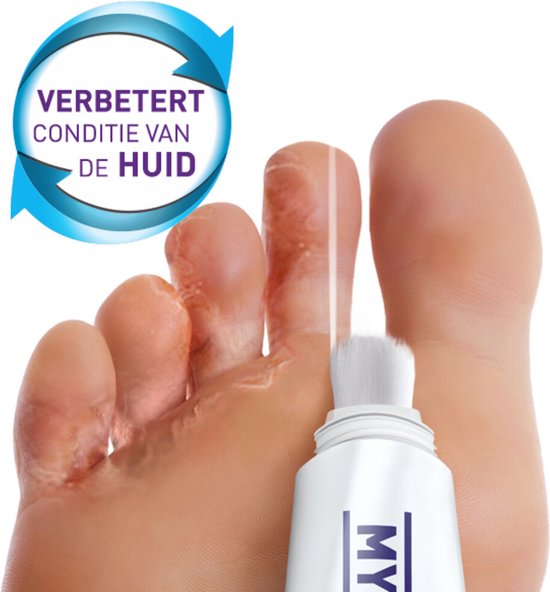 Mycosan voetschimmel 15 ml