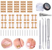 16 stuks - ingegroeide teennagel - ingegroeide teennagel corrector - ingegroeide teennagel tool -ingegroeide teennagel pleister - ingegroeide teennagelset -ingegroeide teennagel set -ingegroeide teennagel gaas - nagelbeugeltjes ingegroeide nagel