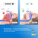 Diagram dat laat zien hoe Mr. Anti Snore snurken voorkomt door de onderkaak in positie te houden.