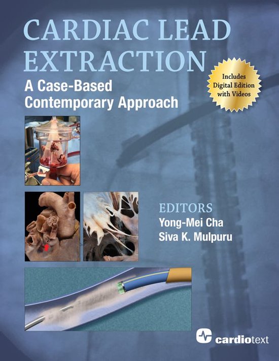 Cardiac Lead Extraction: A Case-Based Contemporary Approach - cover
