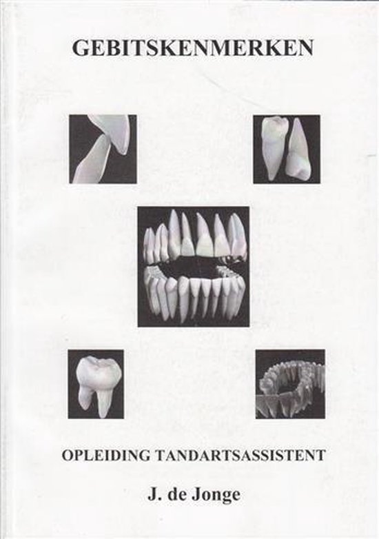 Gebitskenmerken