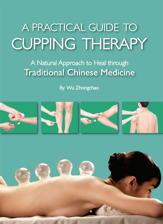 Practical Guide to Cupping Therapy