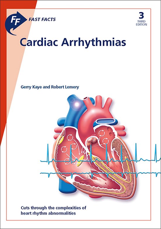 Fast Facts: Cardiac Arrhythmias - cover