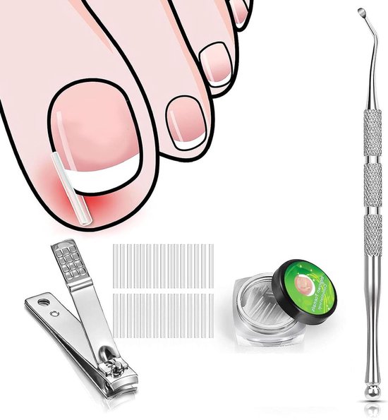 Foto: Ingegroeide teennagel corrector behandeling tool sets 60 stks c type strips gebogen lifter nail clipper teennagel correctie gereedschap nagelbeugel