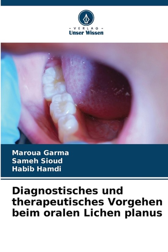 Cover van het boek Diagnostisches und therapeutisches Vorgehen beim oralen Lichen planus, met een close-up van tanden en tandvlees.