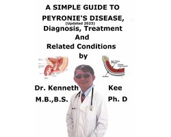 A Simple Guide to Peyronie’s Disease, (Updated 2023) Diagnosis, Treatment and Related Conditions