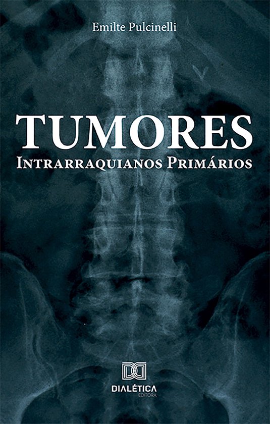 Tumores Intrarraquianos Primários - cover