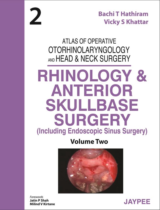 Rhinology and Anterior Skullbase Surgery - cover