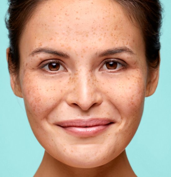 Biodermal Oog make-up remover - Milde gezichtsreiniging - 100ml - Biodermal