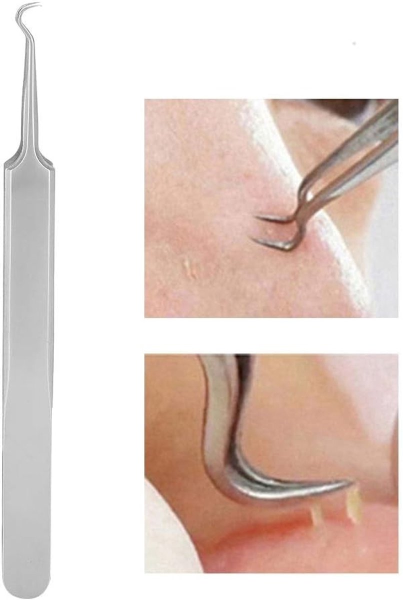 Precisie RVS Pincet voor het Verwijderen van Mee-eters en Acne – Gebogen Haak voor Effectieve Comedone Lift en Pimple Expressie Tools
