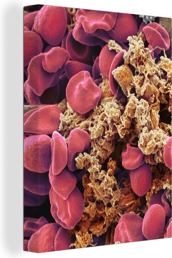 Canvas Schilderij Rode bloedcellen met bloedplaatjes - 30x40 cm - Wanddecoratie