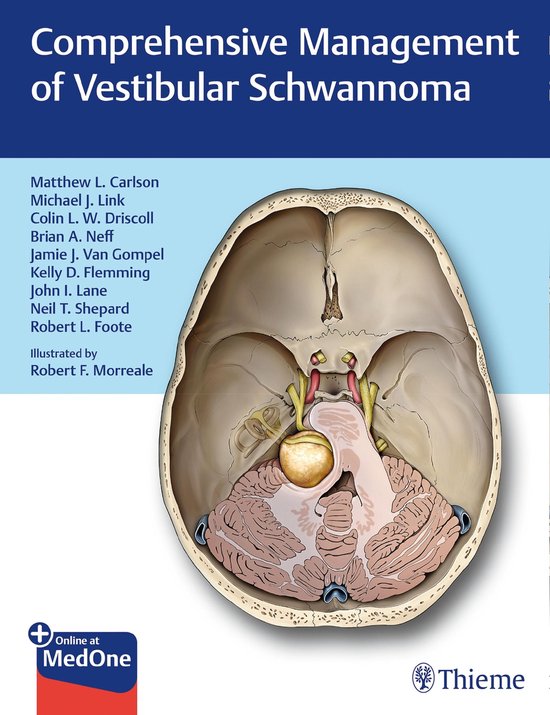 Comprehensive Management of Vestibular Schwannoma - cover