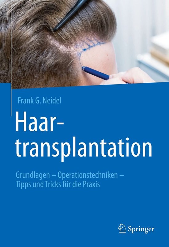 Haartransplantation - cover