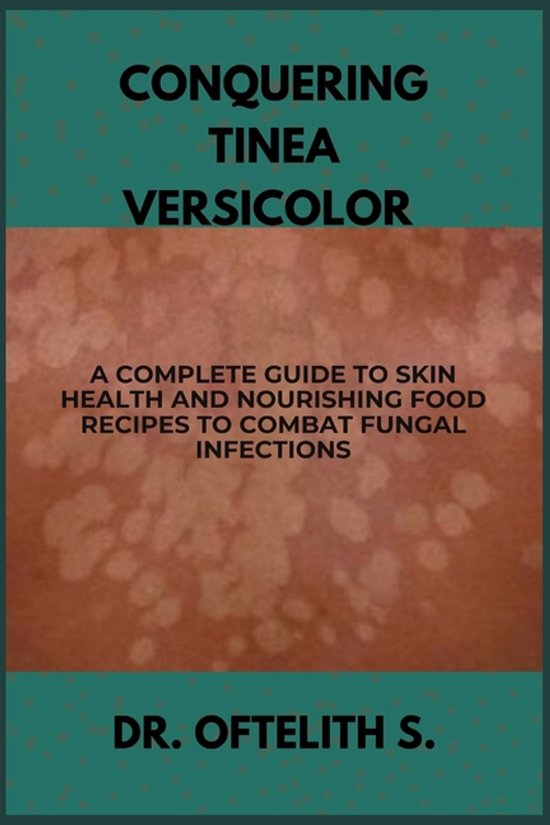 Conquering Tinea Versicolor - cover
