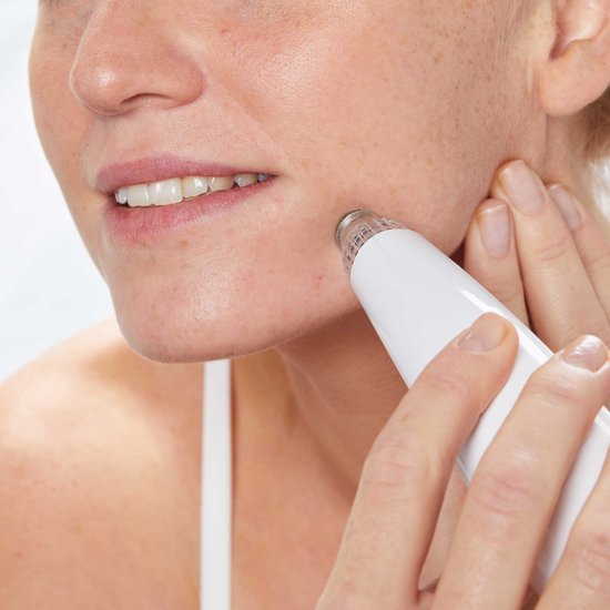 Appareil D'aspiration Anti Points Noirs Et Comédons - Pour Le Visage - Neuf Sous Emballage - Sans Ingrédients Nocifs