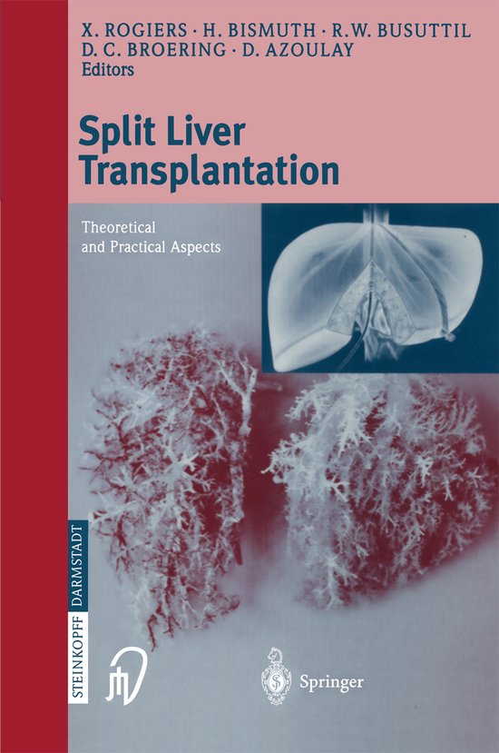 Split liver transplantation - cover