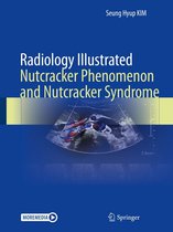 Radiology Illustrated - Radiology Illustrated: Nutcracker Phenomenon and Nutcracker Syndrome
