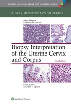 Biopsy Interpretation Of Uterine Cervix