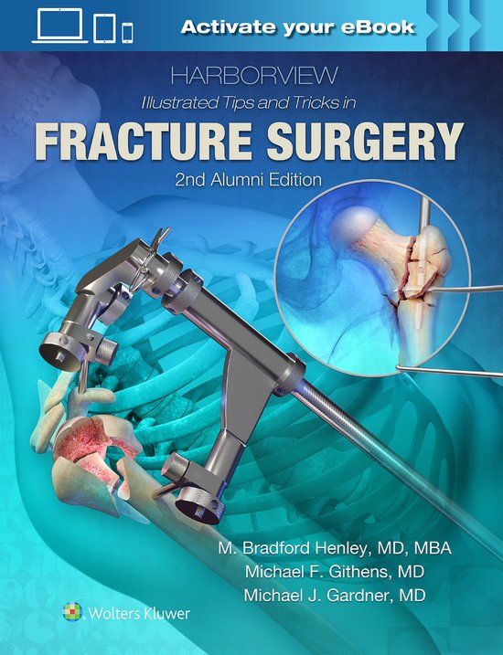 Harborview Illustrated Tips and Tricks in Fracture Surgery - cover