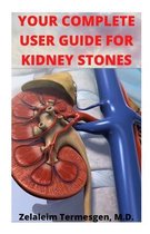 Your Complete User Guide for Kidney Stones