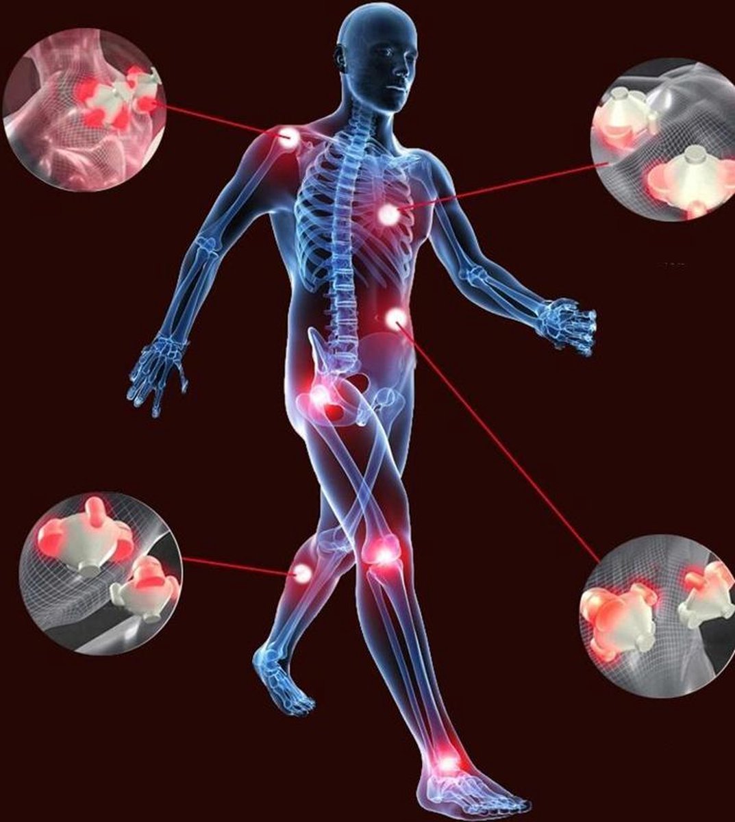 LuxeBass Elektrisch Shiatsu Nek en Schouder Massage Kussen met Arm Lussen ? Nekmassagekussen / massager met kneedmassage nekpijn - Apparaat Geschikt voor Nek/Schouders/Rug/Benen/Voeten/Kuit - Incl. Auto Stekker — cadeau in Verzorging - foto 3