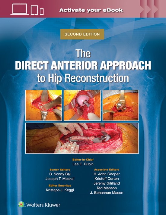 The Direct Anterior Approach to Hip Reconstruction - cover