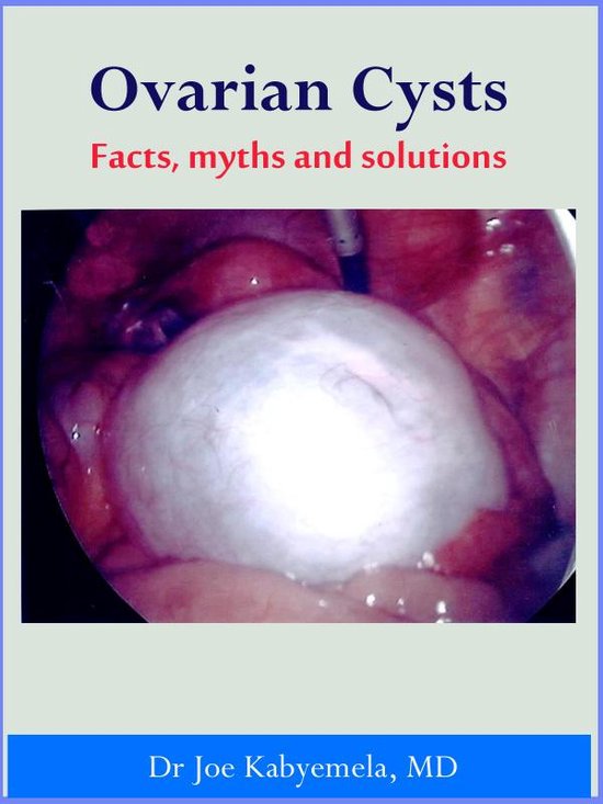 Ovarian Cysts A-Z: Facts, Myths and Solutions - cover