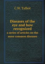 Diseases of the eye and how recognized a series of articles on the more common diseases