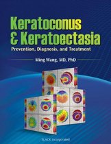 Keratoconus and Keratoectasia
