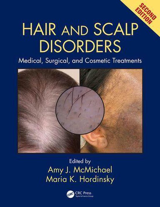 Hair and Scalp Disorders - cover