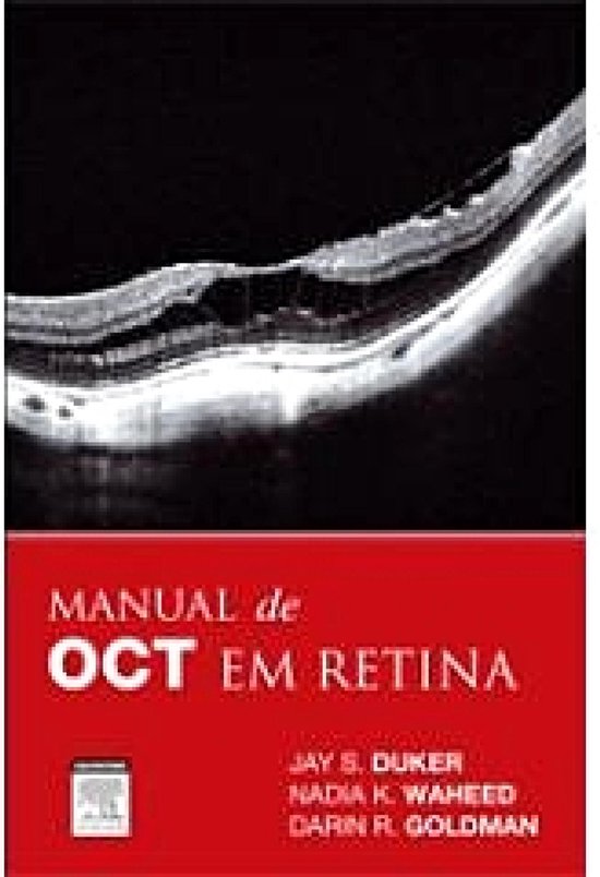 Manual de OCT em Retina (ebook), Darin Goldman | 9788535283334 | Boeken ...