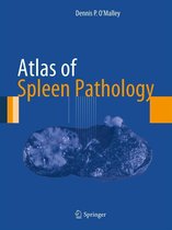 Atlas of Anatomic Pathology - Atlas of Spleen Pathology