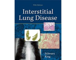 Interstitial Lung Disease