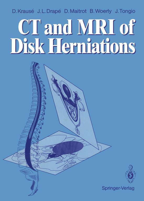 Medicine (R0) - CT and MRI of Disk Herniations - cover