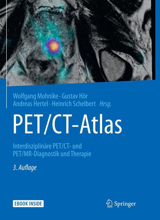 PET/CT-Atlas (ebook) | 9783662488423 | Boeken | bol