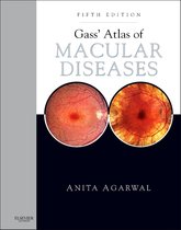Gass' Atlas Of Macular Diseases