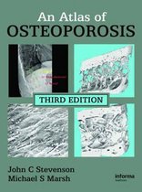 An Atlas of Osteoporosis