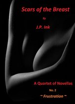Scars of the Breast 2 - Scars of the Breast - Book 2 - Frustration
